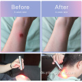 LED-Therapielicht für die Hautverjüngung Schönheit der Haut